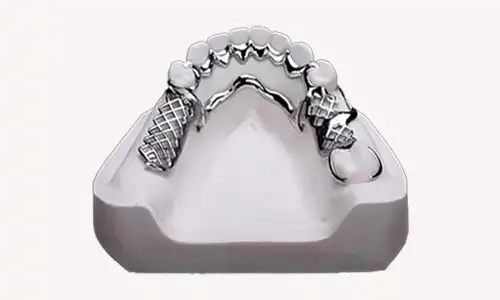 Titanium Partials Procurement for Lightweight Prosthetic Workflows